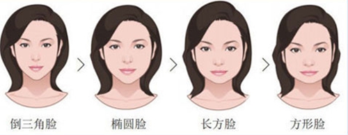 上海华美医疗美容医院,v-line手术,怎么样