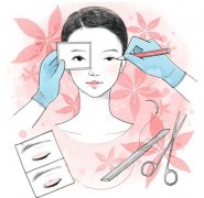 韩式微创双眼皮果能维持多久 韩式微创双眼皮果能维持多久