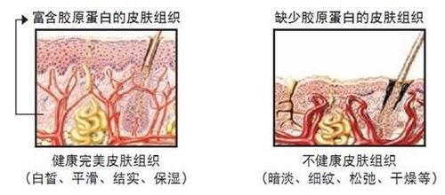 什么是胶原蛋白,胶原蛋白的作用