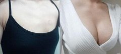 隆胸假体为什么会破裂