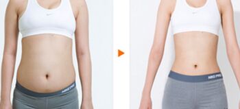 腹部抽脂手术一般要多少钱