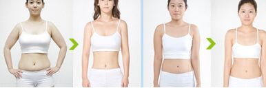 抽脂手术有什么危害