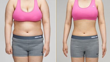 全身抽脂手术多少钱