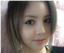 假体隆鼻术果能维持多久