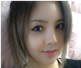 假体隆鼻术,果,能维持多久