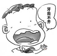 孩子牙齿畸形怎么办
