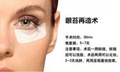 北京眼苔再造价格是多少