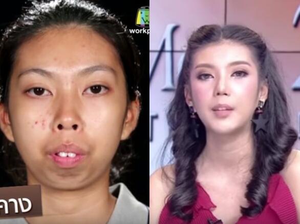 泰国,暴牙妹,整容,**,超出想象