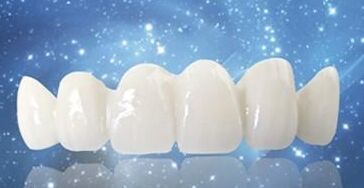 做烤瓷牙要多长时间