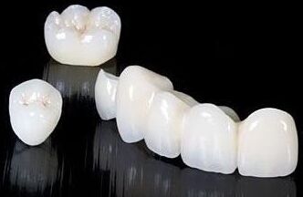 做烤瓷牙危险吗