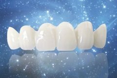 如何辨别烤瓷牙的好坏