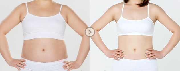 腰腹部吸脂后塑身衣要穿多久