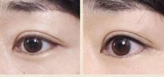 做了美瞳线之后多久补色 做了美瞳线之后多久补色