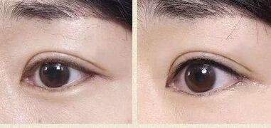 做了美瞳线之后多久补色