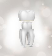 烤瓷牙需要定期更换吗