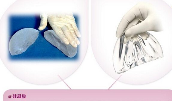 丰胸假体材料有哪些 价格分别多少