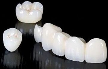 烤瓷牙修复的果好不好