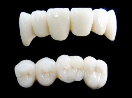 做了烤瓷牙后要怎么保养