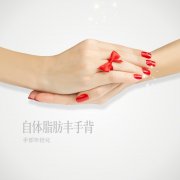 北京自体脂肪填充手部多少钱