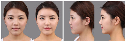 北京,八大处,整形,医院,隆鼻,好吗,多少钱