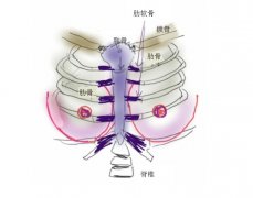 郑州鸡胸整形手术多少钱