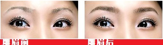 太原,雕眉,多少钱