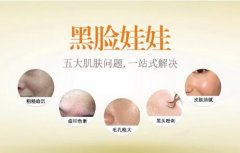什么是黑脸娃娃 黑脸娃娃恢复时间短吗