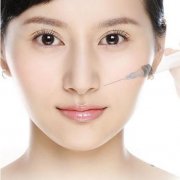 西南医院美容科玻尿酸除皱多少钱