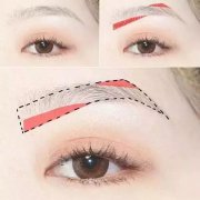 北京一字眉改型术多少钱