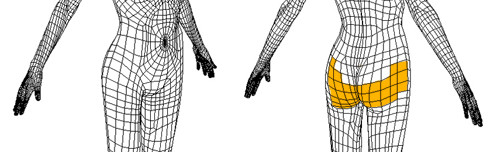 假体,丰臀,要多久,才能,恢复