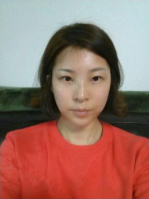 北京基础美注射丰额头 成就我的女神梦