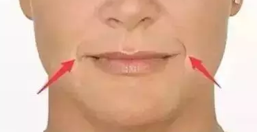 福州,名韩,注射,除皱,好吗,价格表