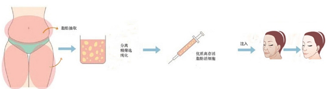 福州,名韩,注射,除皱,好吗,价格表