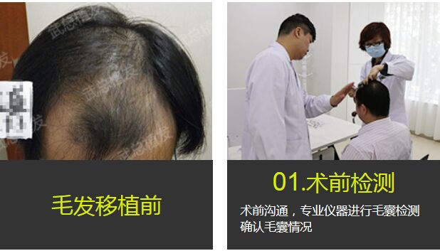 武汉,武总植发,专科,门诊,特惠,价格表,来啦