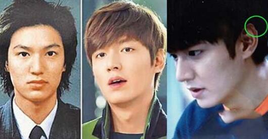 李敏镐整容前后照片对比差距惊人