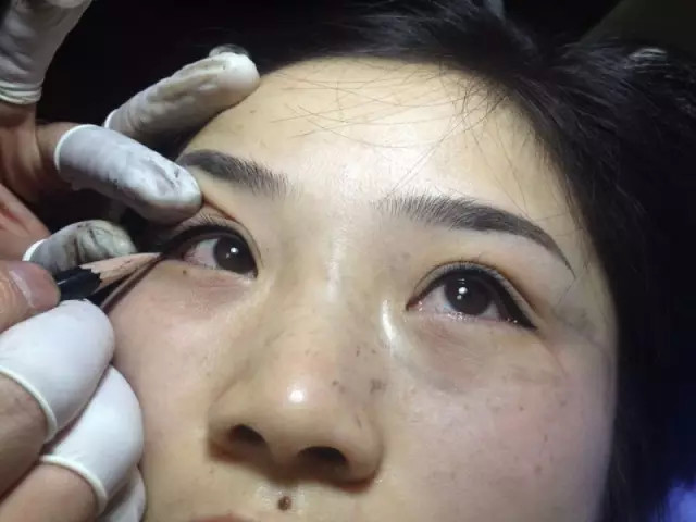 双眼皮和美瞳线一起做 让你拥有勾魂媚眼