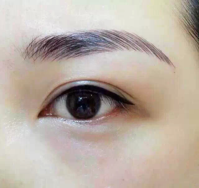 双眼皮和美瞳线一起做 让你拥有勾魂媚眼