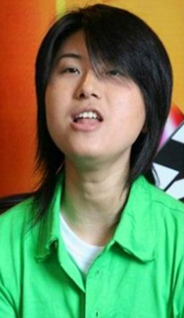 尚雯婕整容了吗 尚雯婕整容前后对比照片曝光