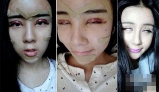 三元整形网 资讯 整形新闻   李蒽熙整容前饱满瓜子脸,还有萌萌大眼睛