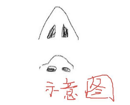 高圆圆是不是整容了 高圆圆整形对比图