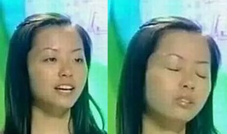 张靓颖整容了吗 张靓颖整容前后照片对比