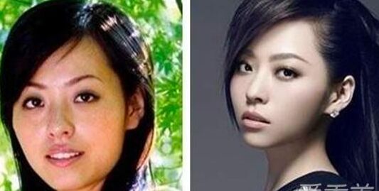 张靓颖整容了吗 张靓颖整容前后照片对比