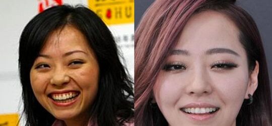 张靓颖整容了吗 张靓颖整容前后照片对比