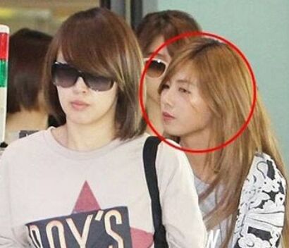 泫雅整容前照片丑哭 素颜变大婶