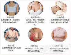 广州广美假体隆胸整形怎么样？价格表？
