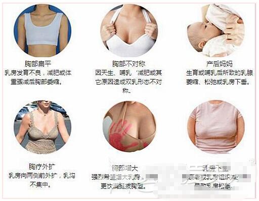 广州,广美,假体,隆胸,怎么样,价格表