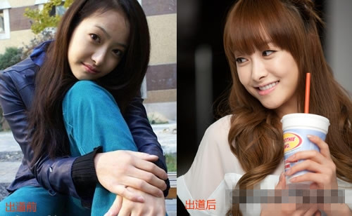 宋茜到底整容了没有 宋茜整容对比