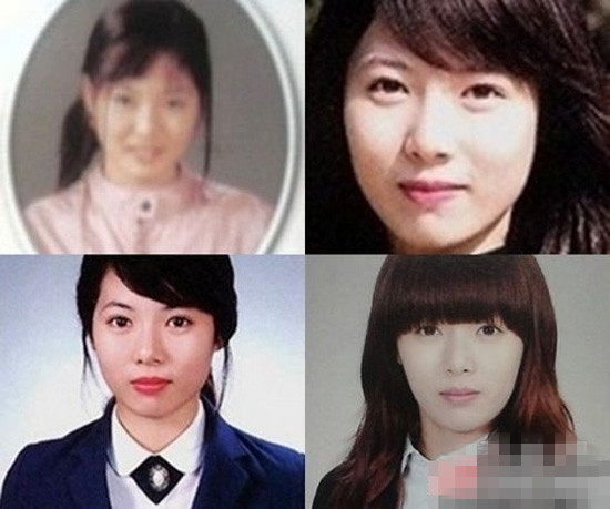 泫雅整容前照片丑哭 素颜变大婶