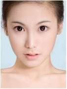 开眼角手术价格一般多少钱