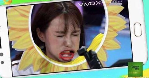 沈梦辰整容对比图 下巴塞的假体被发现 